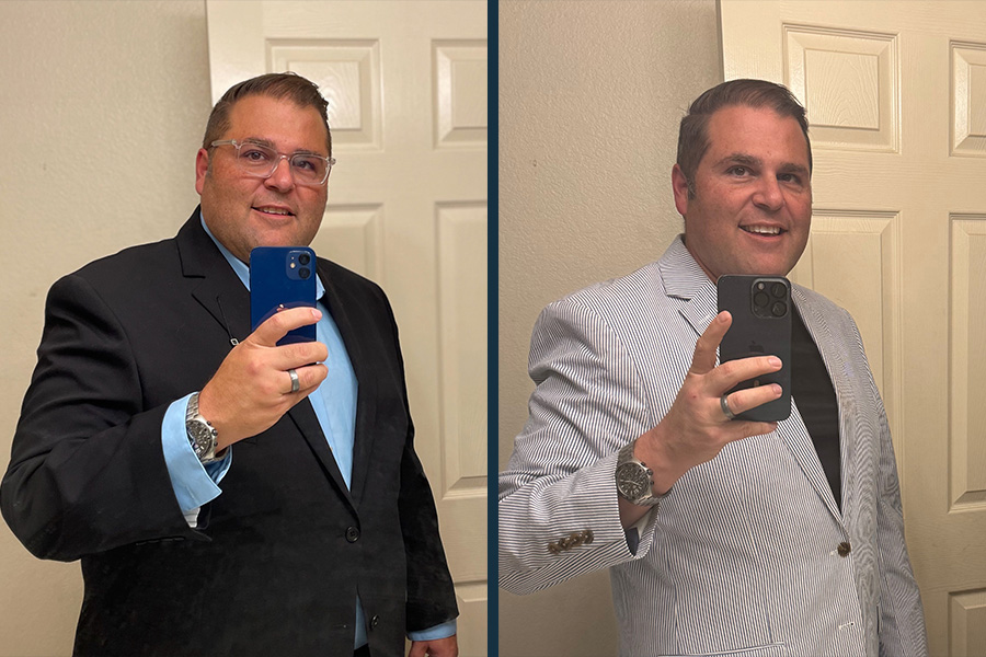 Before and after weight loss with GLP-1 medication